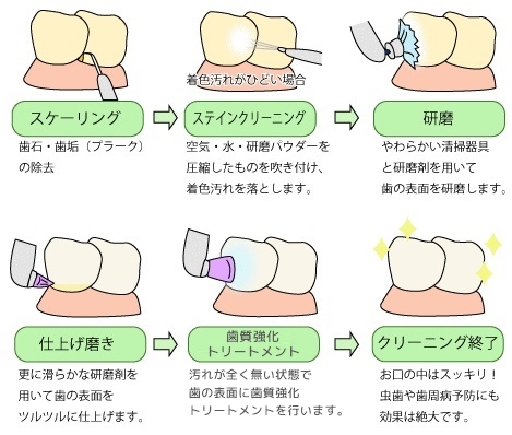 PMTCの流れ